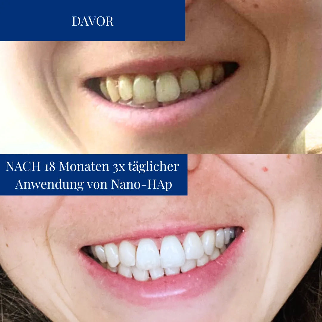 Zahnschmelz Routine Set