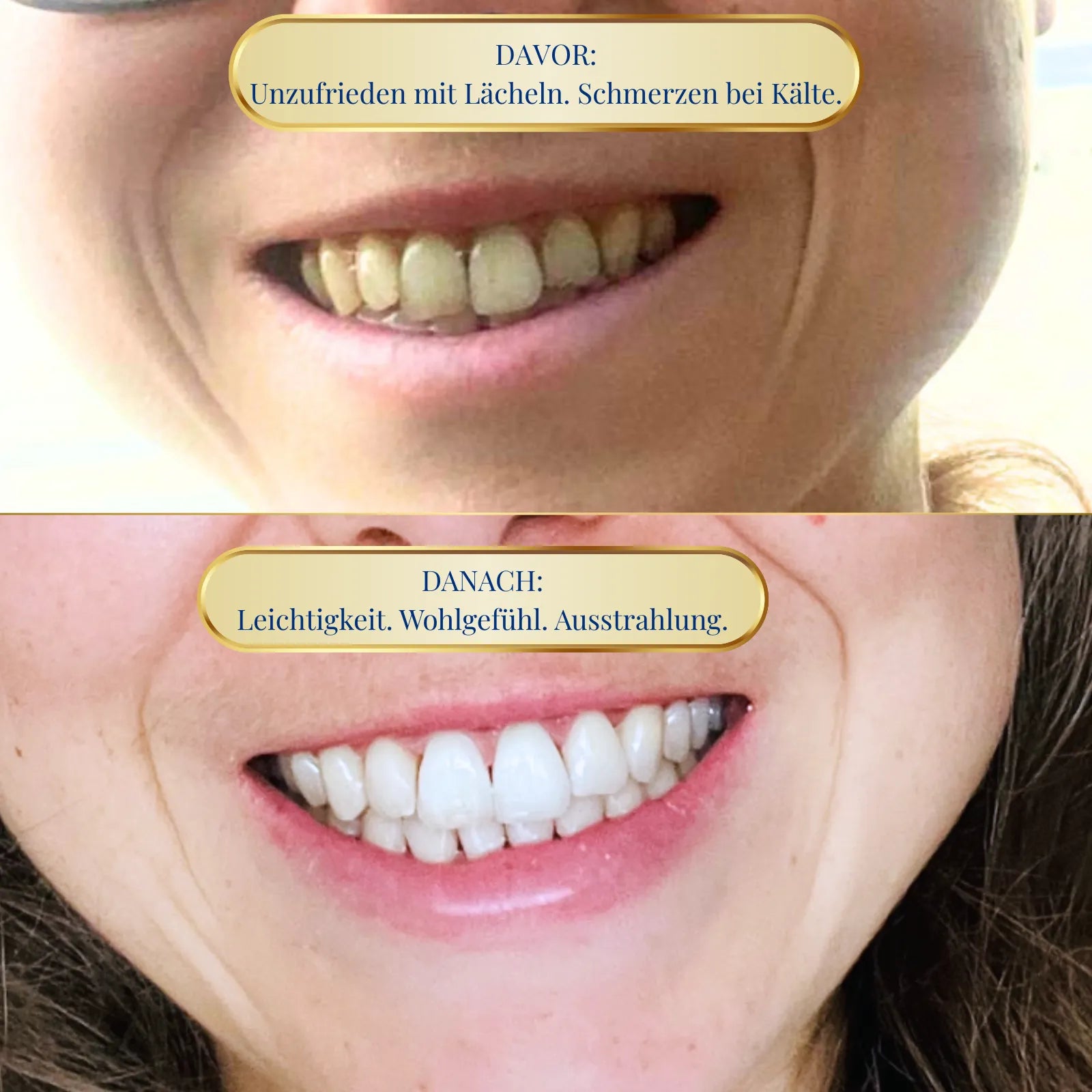 Sensitive Care Bundle