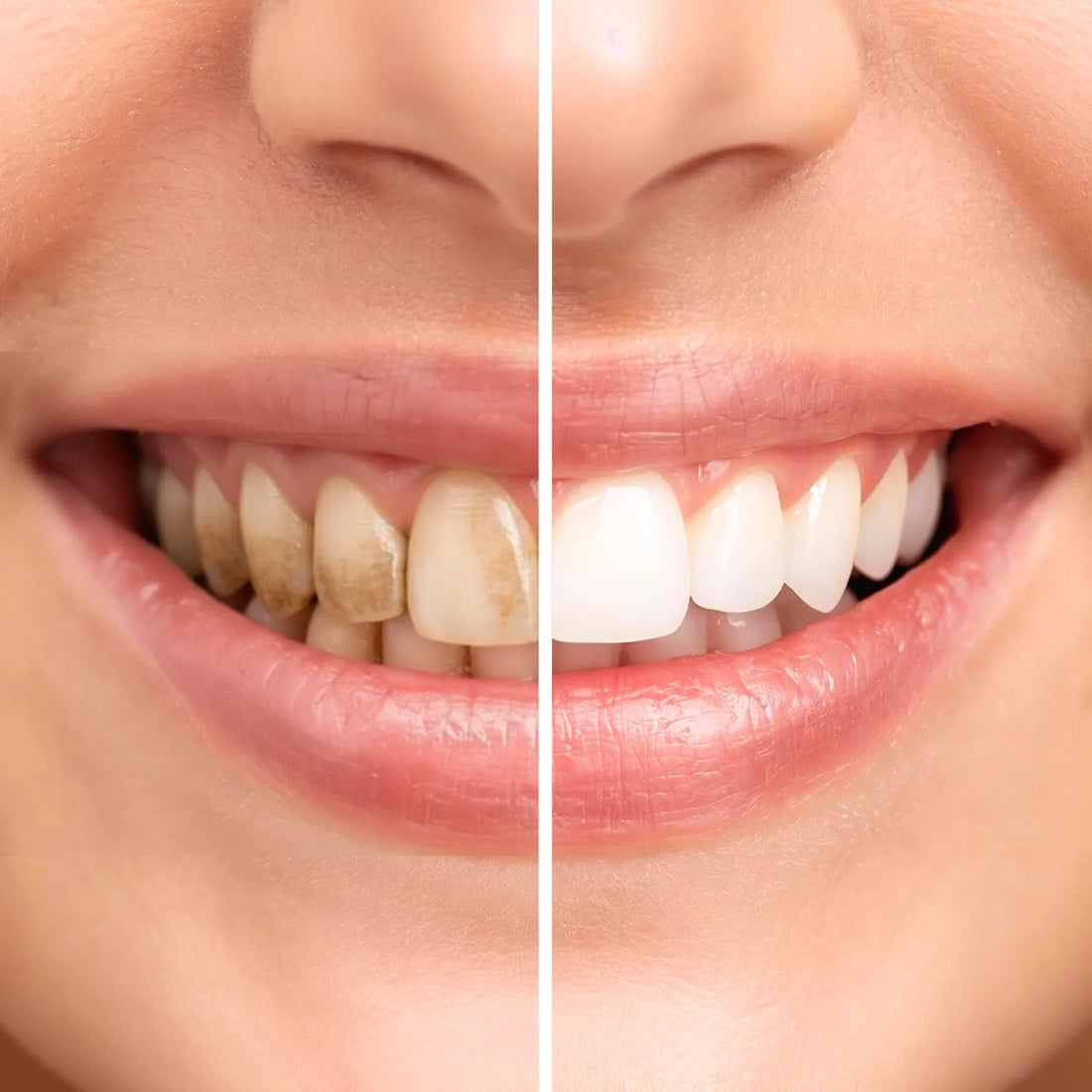 Dual Action Sensitive Care Bundle