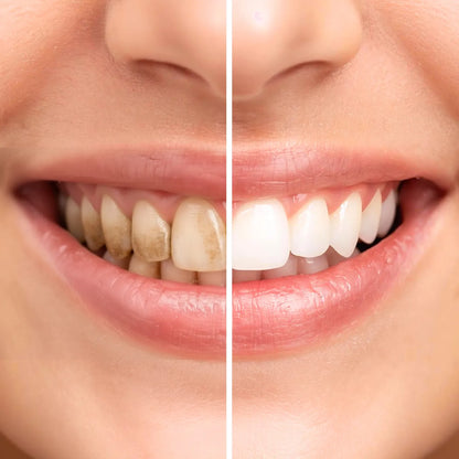 Dual Action Sensitive Care Bundle